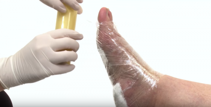 Enrolando o pé com plástico filme para segurar as bandagens