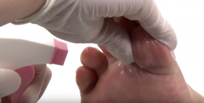 Limpando os pés com borrifador de água.